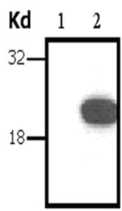Monoclonal Mouse anti-Human DIRAS3 / ARHI Antibody (clone 1218, WB)