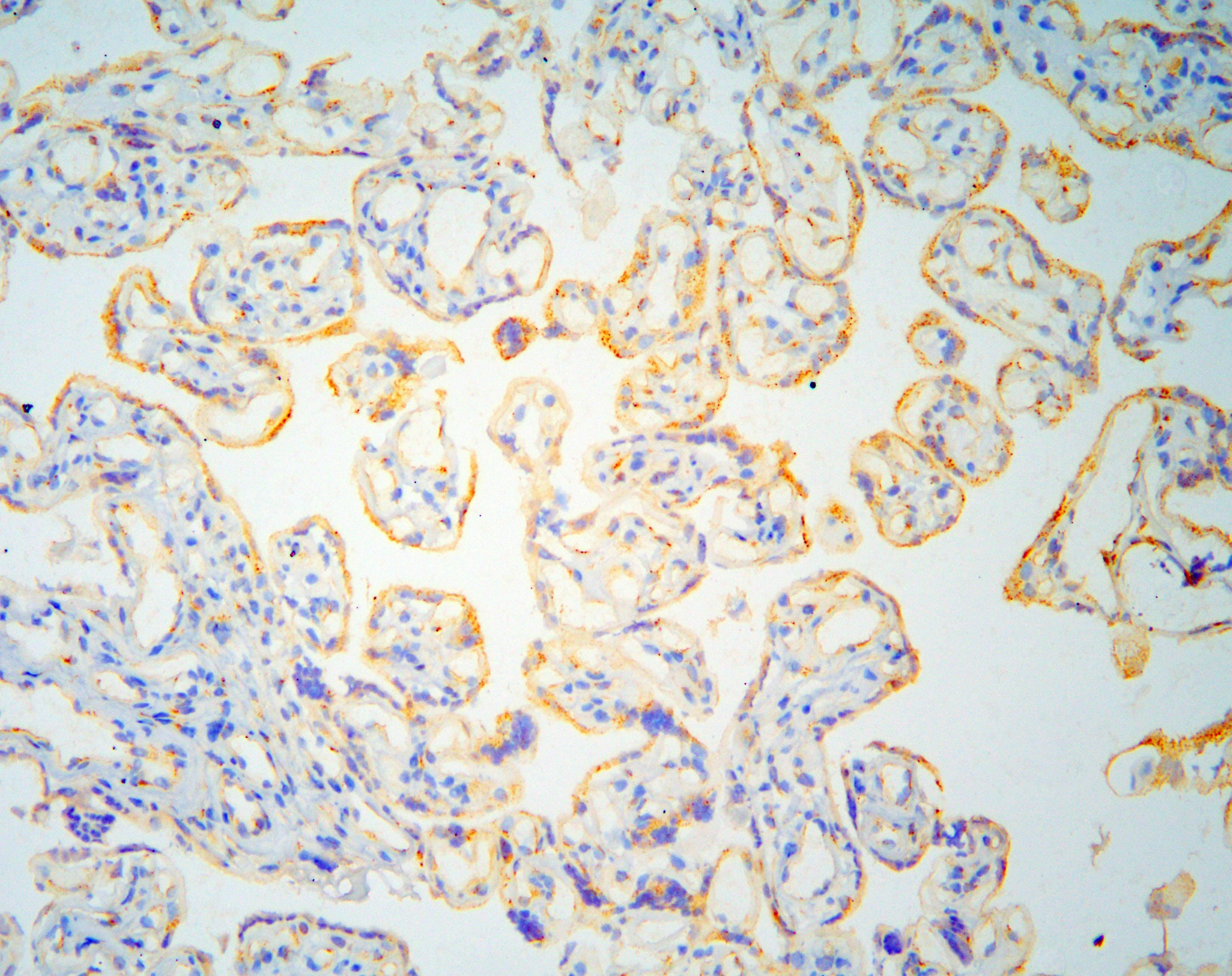 Polyclonal Rabbit anti-Human GOLGA2 / GM130 Antibody (IHC, WB)