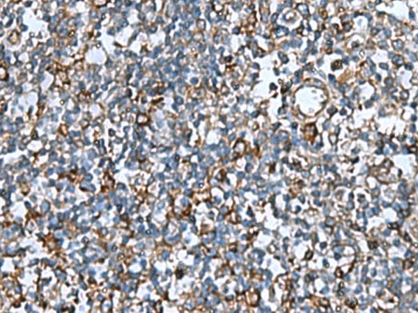 COMMD9 Antibody