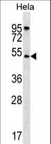 Polyclonal Rabbit anti-Human AKT1 Antibody (aa115-144, IHC, IF, WB)