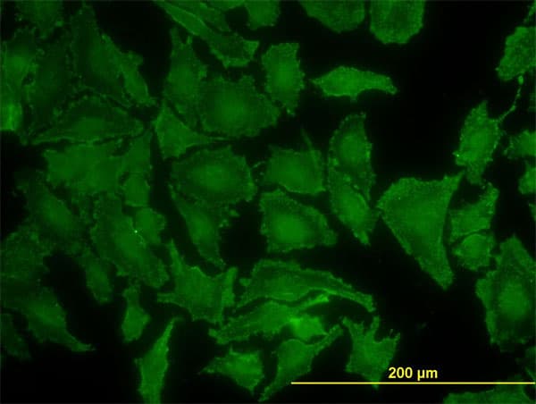 Monoclonal Mouse anti-Human KRAS Antibody (clone 3B10-2F2, IF, WB)