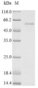 Human Immunodeficiency Virus 1 HIV-1 Vif Protein (Recombinant 6His-SUMOstar, N-terminus)