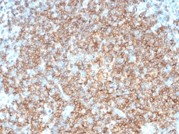 Monoclonal Mouse anti-Human CD22 Antibody (clone BLCAM/1795, IHC, WB)