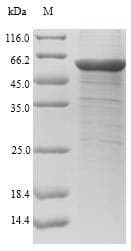 Human CHI3L1 / YKL-40 Protein (Recombinant 10His-SUMO, N-terminus + Myc, C-terminus)