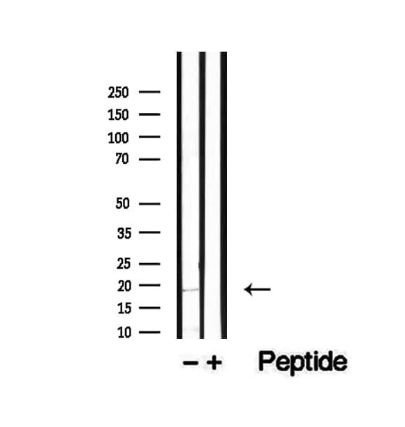 Polyclonal Rabbit anti-Human TMEM70 Antibody (IHC, WB)