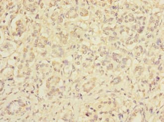 Polyclonal Rabbit anti-Human RXFP3 Antibody (IHC)