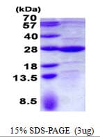 Human GLTP Protein (Recombinant His)