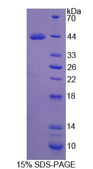 Human P4HA2 Protein (Recombinant His)