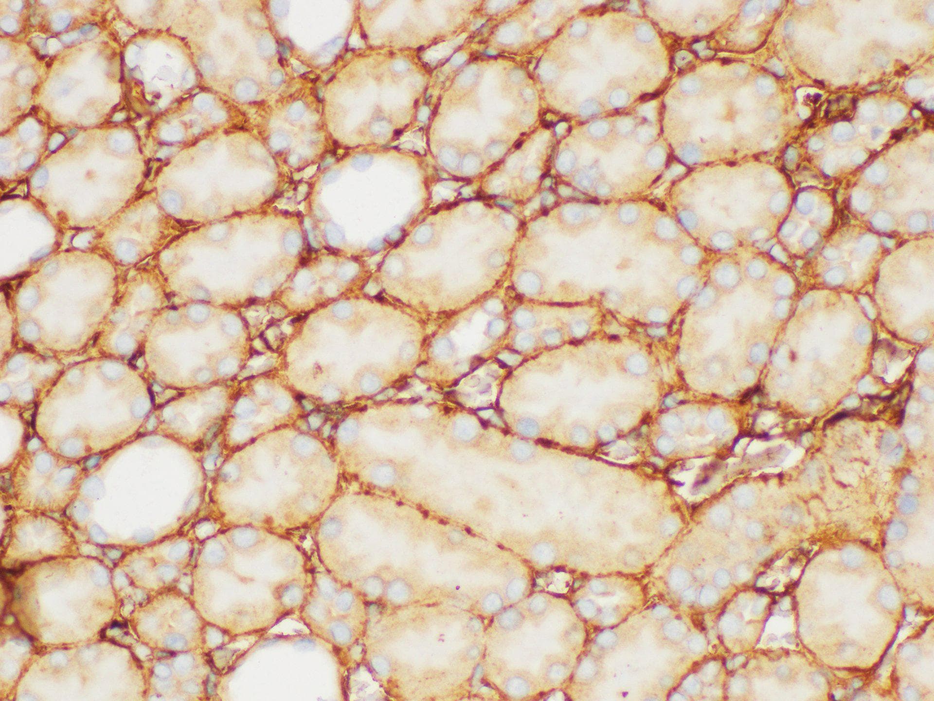 FGB / Fibrinogen Beta Chain Antibody