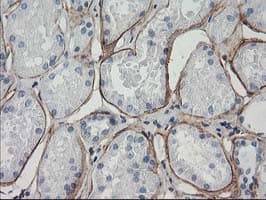 ARH / LDLRAP1 Antibody (clone OTI7E11)
