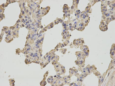 IHC-plus™ OGT / O-GLCNAC Antibody