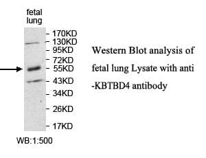 KBTBD4 Antibody (aa247-417)