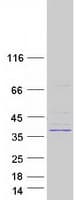 Human MAGEF1 Protein (Recombinant Myc-DDK (Flag))