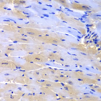 Polyclonal Rabbit anti-Human CUL2 / Cullin 2 Antibody (IHC, IF, WB)