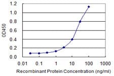 Monoclonal Mouse anti-Human CTBS / CTB Antibody (clone 1B5-1B9, WB)