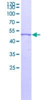 Human RBM24 Protein (Recombinant GST)
