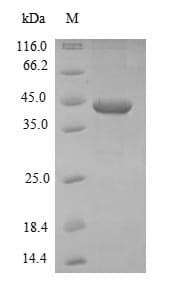 Staphylococcus aureus isdB Protein (Recombinant 6His-SUMO, N-terminus)