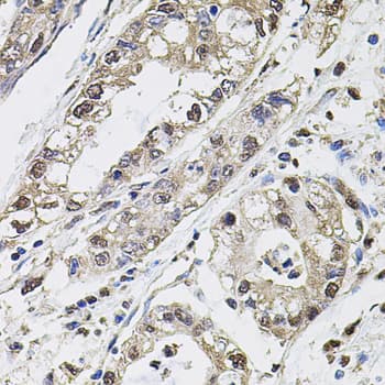 IHC-plus™ Polyclonal Rabbit anti-Human CA9 / Carbonic Anhydrase IX Antibody (IHC, WB)