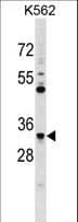 FCN1 / Ficolin-1 Antibody (aa239-267)