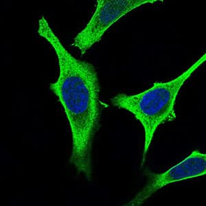 GABBR2 / GABA B Receptor 2 Antibody (aa319-483, clone 5G7F7)