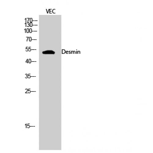 Polyclonal Rabbit anti-Human DES / Desmin Antibody (390-470 aa, C-terminal, IHC, IF, WB)