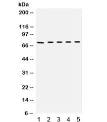 Polyclonal Rabbit anti-Mouse KNG1 / Kininogen / Bradykinin Antibody (IHC, WB)