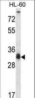 STX6 / Syntaxin 6 Antibody (aa121-149)