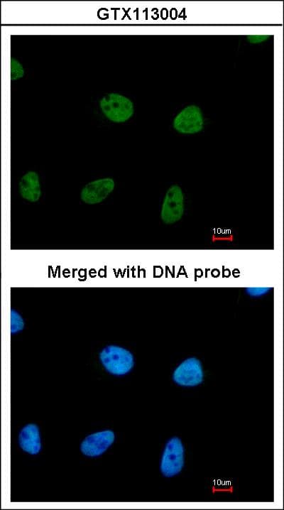 RPA2 / RFA2 / RPA34 Antibody (aa1-202)