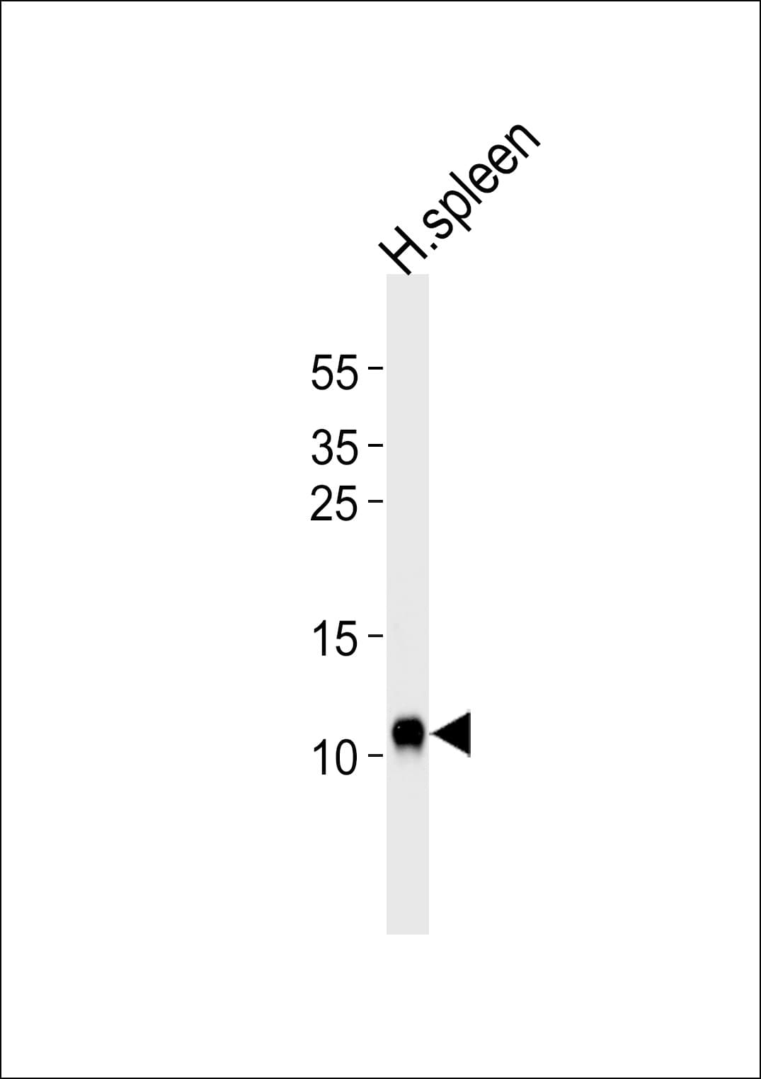 IHC-plus™ Polyclonal Rabbit anti-Human FCER1G Antibody (aa60-86, IHC, WB)