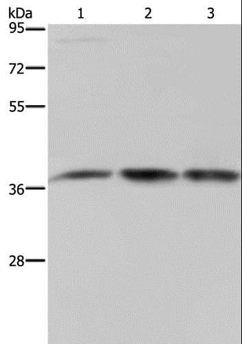 CAB39 / MO25 Antibody