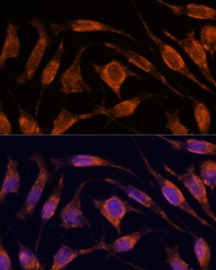 Polyclonal Rabbit anti-Human IPO4 Antibody (IF)