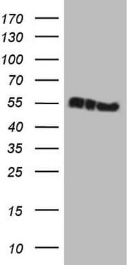 KRT16 / CK16 / Cytokeratin 16 Antibody (clone OTI2E6)