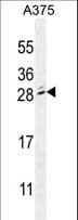MBD3L2 Antibody (aa176-204)