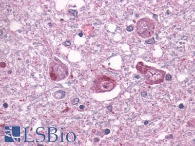 PathPlus™ TAAR1 / TA1 Antibody (Extracellular Domain)