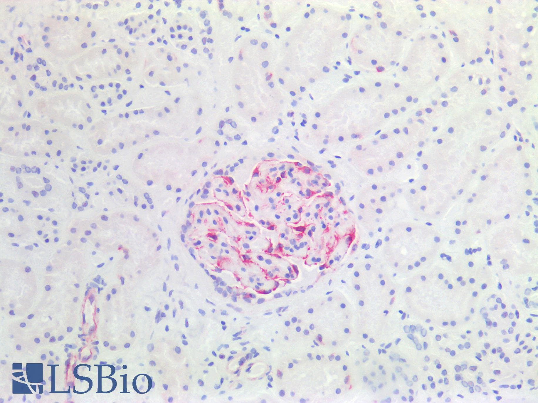 PathPlus™ Vimentin Antibody (clone AT5H8)