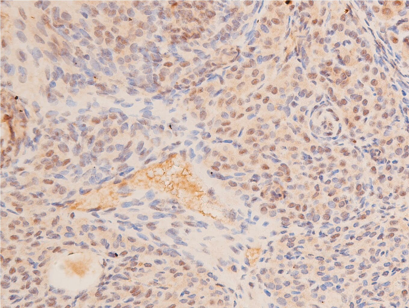 TP53 / p53 Antibody (Acetyl-Lys317)