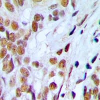 SSB / La Antibody (phospho-Ser366)
