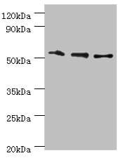 Polyclonal Rabbit anti-Human RMDN3 Antibody (aa171-470, IHC, WB)