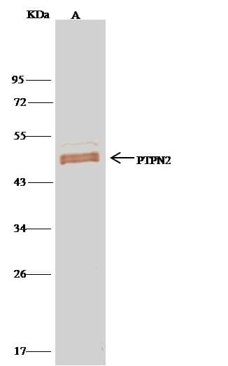 Polyclonal Rabbit anti-Human PTPN2 / TC-PTP Antibody (Preservative Free, WB)