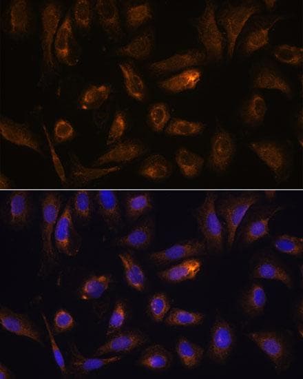RGS4 Antibody