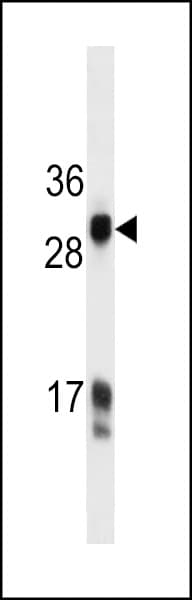 KLK3 / PSA Antibody (aa220-250)