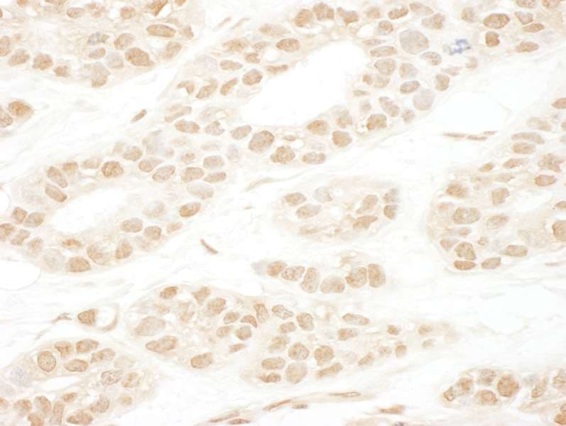 NCAPH2 / CAP-H2 Antibody (aa425-475)