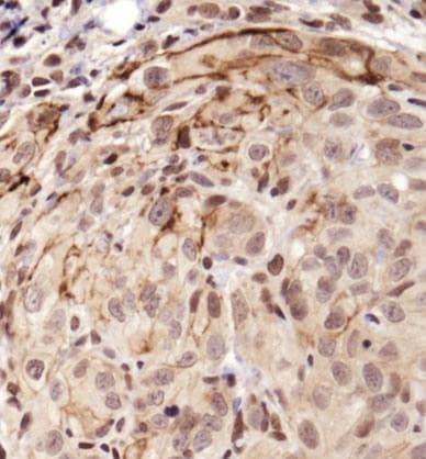 NOTCH1 Antibody
