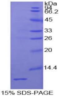 Human IGF2 Protein (Recombinant His)