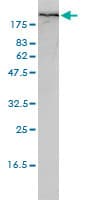 IHC-plus™ FLNA / Filamin A Antibody (clone 4E10-1B2)