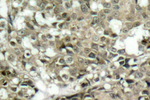 Polyclonal Rabbit anti-Human ABL1 / c-ABL Antibody (Leu406, IHC, WB)