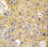 Polyclonal Rabbit anti-Human AARS Antibody (aa61-91, IHC, WB)