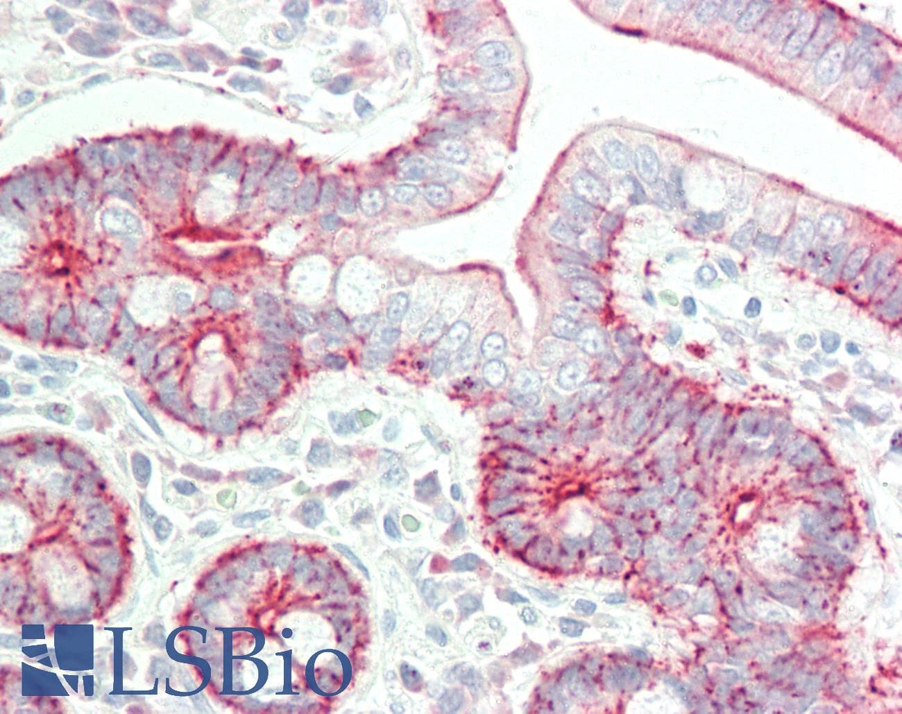 IHC-plus™ Polyclonal Rabbit anti-Human EPLIN Antibody (aa700-C-term, IHC, WB)