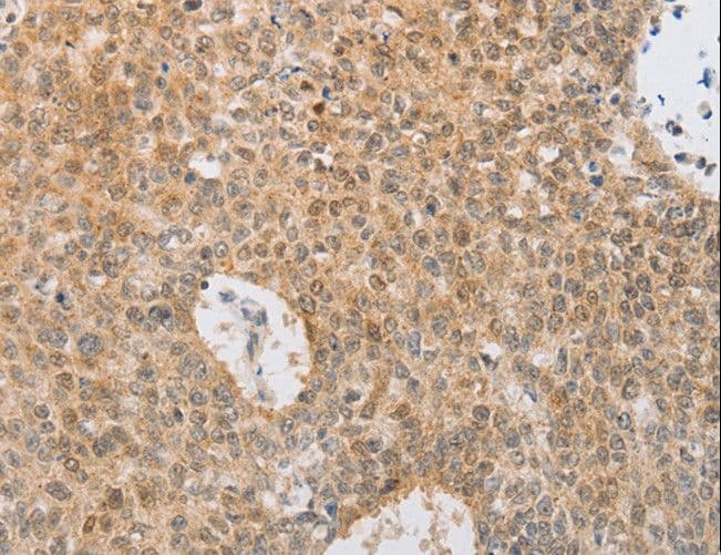 SERPINE2 / Nexin Antibody