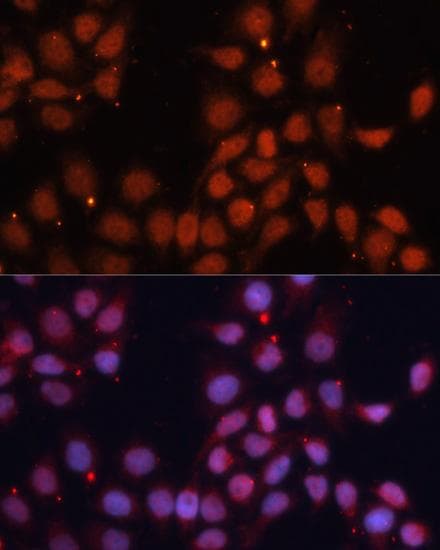 Polyclonal Rabbit anti-Human CDK11B / CDC2L1 Antibody (IF)